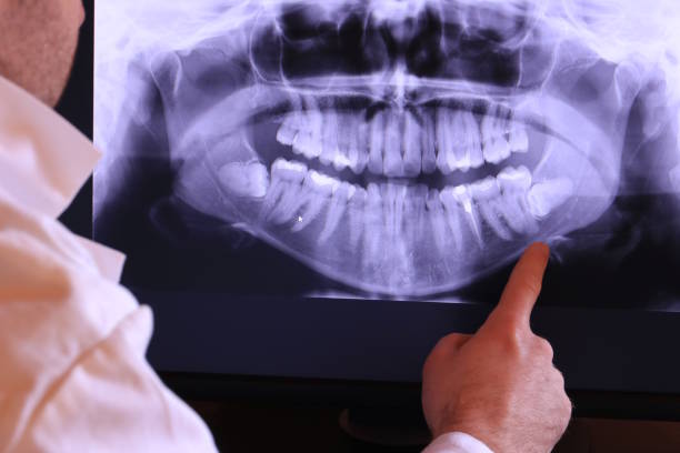 Best Emergency Root Canal Treatment in Nashotah, WI