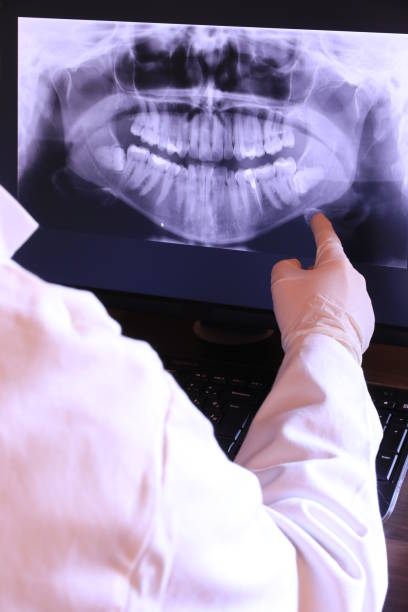 Best Emergency Dentist for Lost Fillings or Crowns in Nashotah, WI